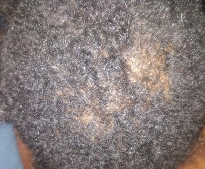 Before image