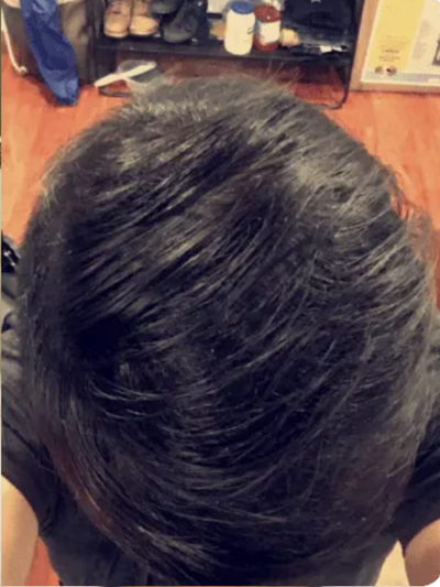 After image