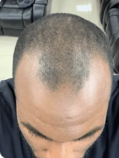 Before image