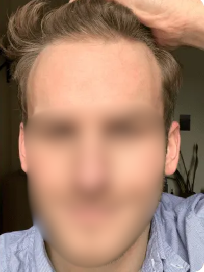 After image