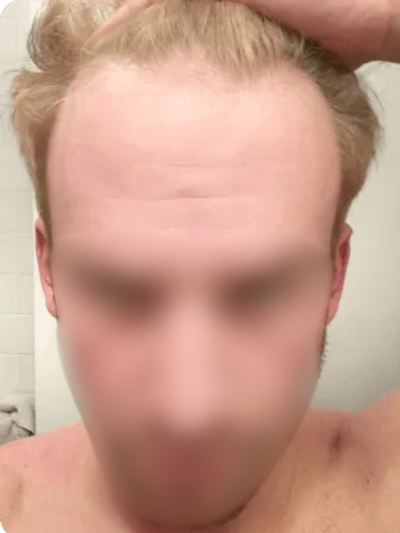 Before image