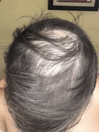 Before image